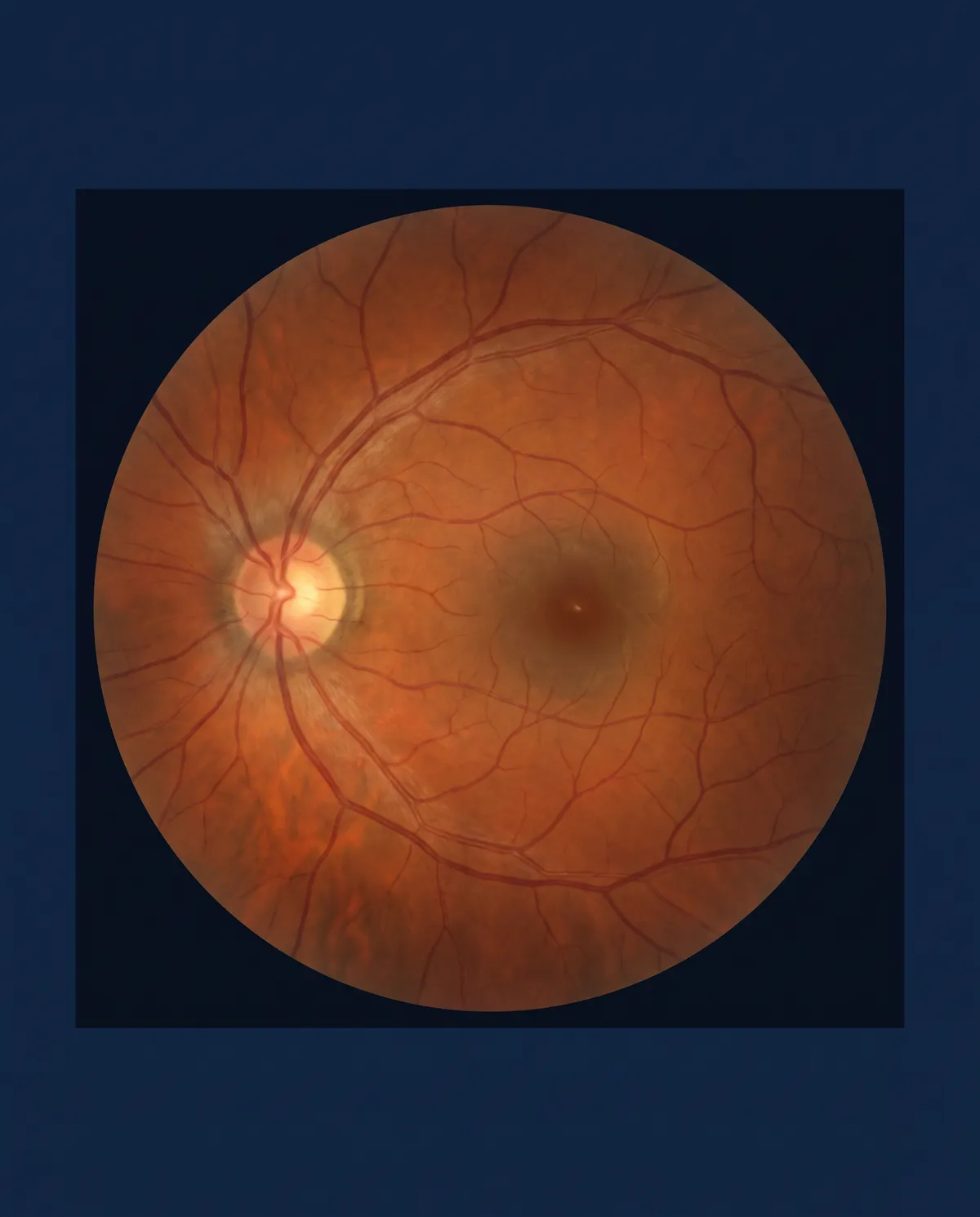 The back of the eye